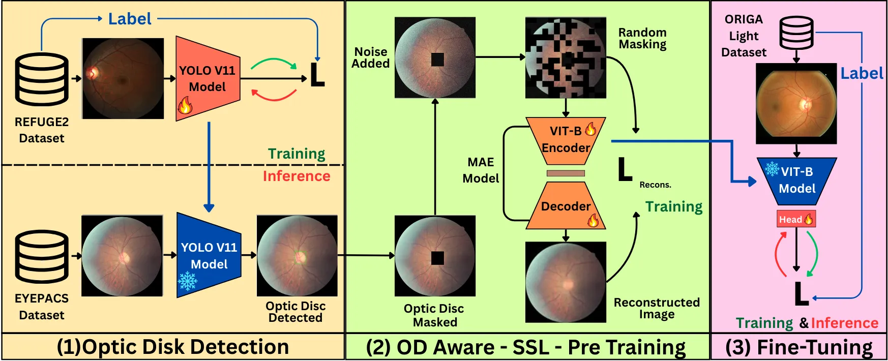 Obscure to Observe: lesion-aware MAE for glaucoma detection, model diagram